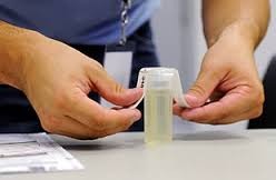 Lab Urine Drug Test